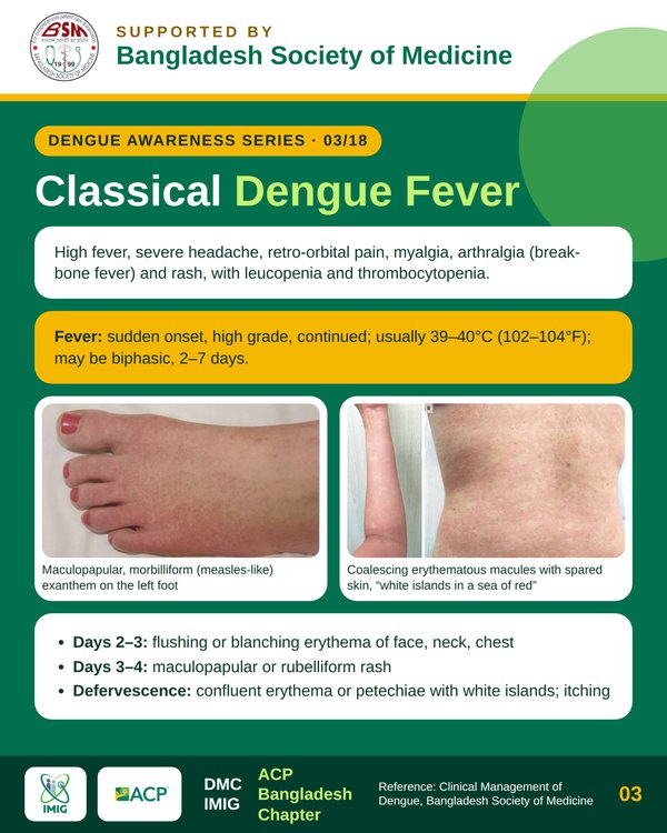 Febrile Illness & Classic Rash Patterns