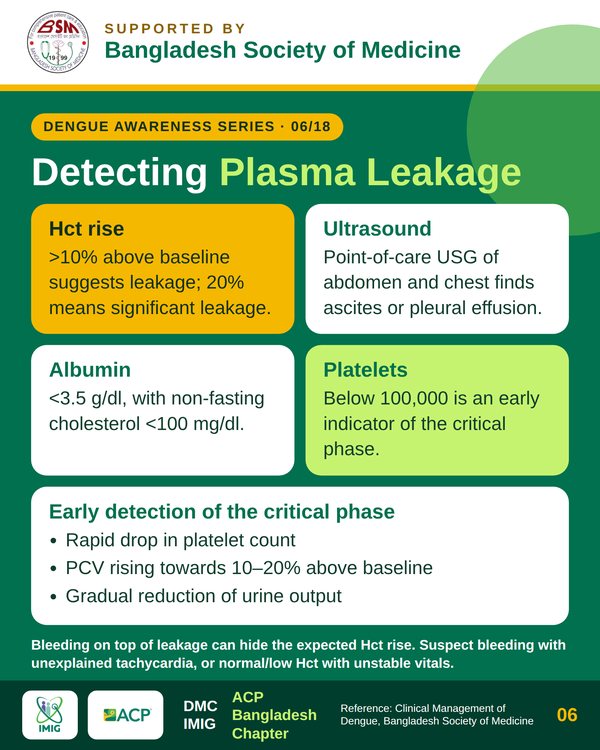 Plasma Leakage: Hallmark of DHF